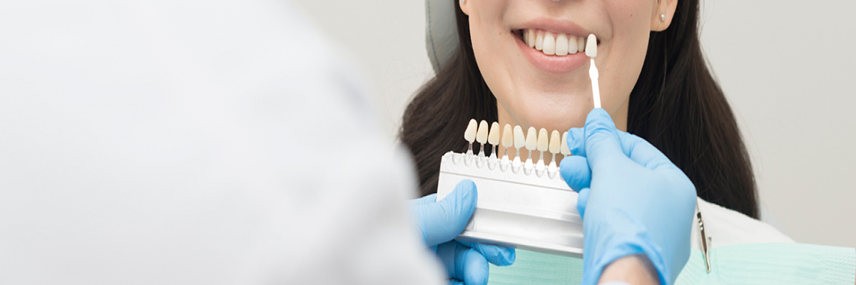 Teeth whitening | Dental clinic Stockholm | Renaissance Dental