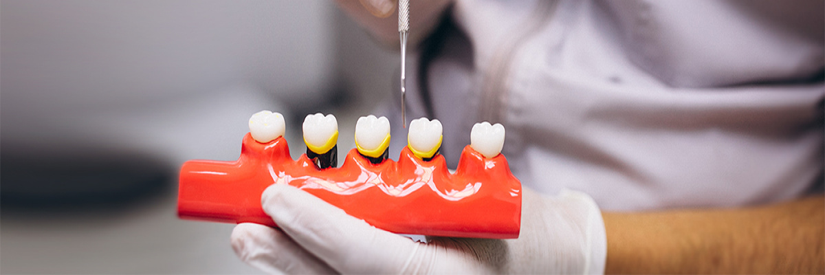Periodontics | Treatments | Symptoms | Renaissance Dental Solna